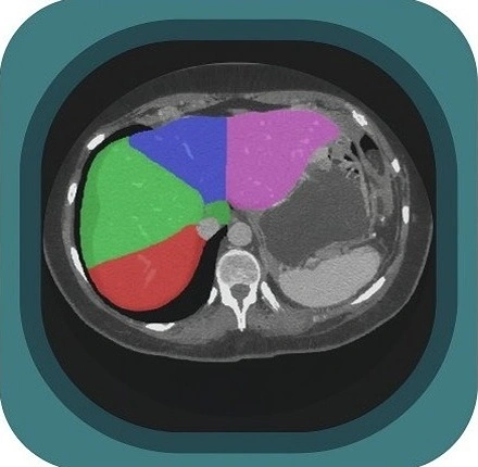 CT liver lobes and segments  anatomy icon
